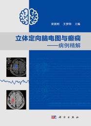 立体定向脑电图与癫痫 病例精解