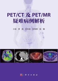 PET/CT及PET/MR疑难病例解析