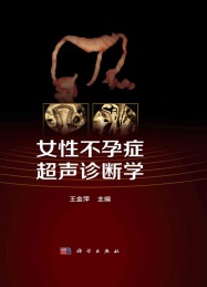 女性不孕症超声诊断学