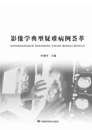 影像学典型疑难病例荟萃