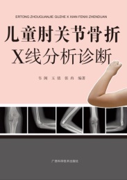 儿童肘关节骨折X线分析诊断