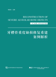 牙槽骨重度缺损修复重建案例解析