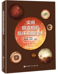 实用眼底相机临床拍摄技术