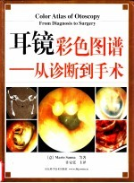 耳镜彩色图谱 从诊断-手术