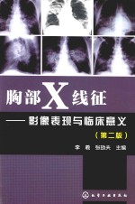 胸部X线征 影像表现与临床意义