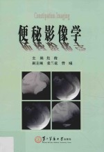 便秘影像学