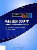 角膜胶原交联术 翻译版