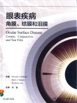 眼表疾病 角膜 结膜和泪膜