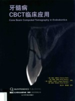 牙髓病CBCT临床应用