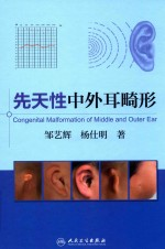 先天性中外耳畸形