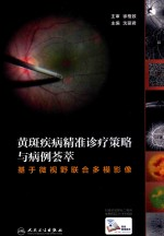黄斑疾病精准诊疗策略与病例荟萃:基于微视野联合多模影像