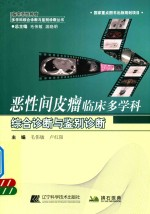 恶性间皮瘤临床多学科综合诊断与鉴别诊断
