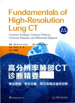 高分辨率肺部CT诊断精要 常见表现,常见征象,常见疾病及鉴别诊断 原书 第2版