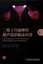 三维子宫输卵管超声造影临床应用