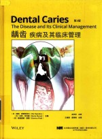 龋齿疾病及其临床管理 第3版
