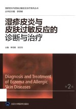 湿疹皮炎与皮肤过敏反应诊疗系列丛书 湿疹皮炎与皮肤过敏反应的诊断与治疗 第2版