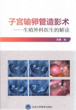 子宫输卵管造影术 生殖外科医生的解读