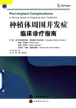 种植体周围并发症 临床诊疗指南
