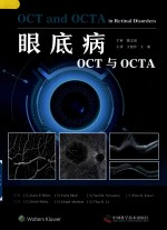 眼底病OCT与OCTA