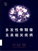 多发性骨髓瘤及其相关疾病