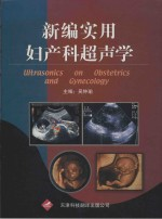 新编实用妇产科超声学