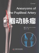 腘动脉瘤