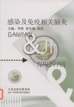 感染及免疫相关脑炎