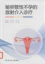 输卵管性不孕的放射介入诊疗