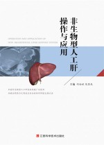 非生物型人工肝操作与应用